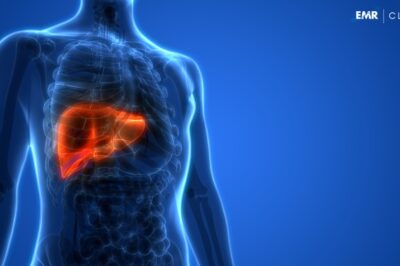 North America Tumor Ablation Market Size, Share, Growth, Trends, Key Players, & Forecast | 2024-2032