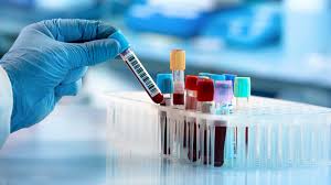 Autoimmune Diseases Diagnostics Market Analysis Size And Forecast Report 2024-2030