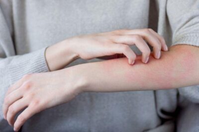 How to Protect the Body from Parasitic Infections