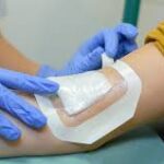 Medical Adhesives Market Size And Forecast Report By Renub Research