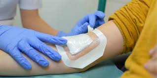 Medical Adhesives Market Size And Forecast Report By Renub Research