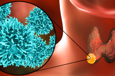 Recurrent or Metastatic Head and Neck Cancer Drug Pipeline Analysis Report 2024