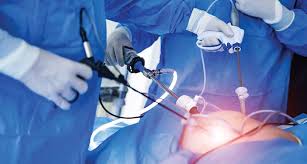 United States Endoscopy Devices Market Analysis Size And Forecast Report 2024-2030 United States Endoscopy Devices Market Analysis Size And Forecast Report 2024-2030