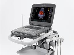 United States Ultrasound Devices Market Analysis Size And Forecast Report 2024-2030