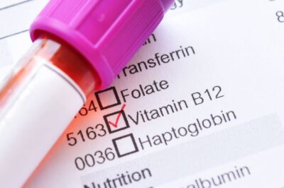 Vitamin B12 Test: Everything You Need to Know