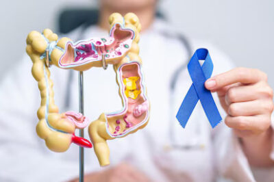 Colon Cancer: Stages, Symptoms & Treatment Techniques