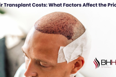 Hair Transplant Costs: What Factors Affect the Price?
