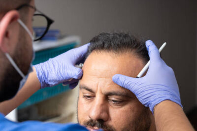 Why Riyadh Is Becoming a Global Hub for Hair Transplant Procedures