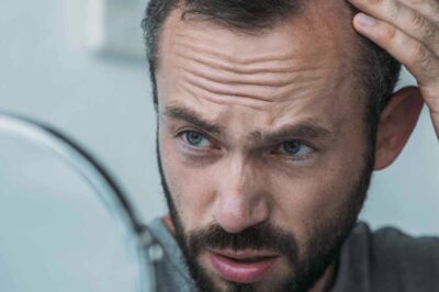 에프페시아: 탈모 치료의 새로운 선택