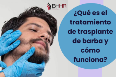 ¿Qué es el tratamiento de trasplante de barba y cómo funciona?