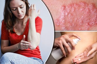 Eczema and Psoriasis Treatment Manufacturing Plant Cost, Setup Layout and Machinery Requirements| Detailed Project Report 2025