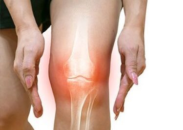 Managing Chronic Knee Pain: A Complete Guide