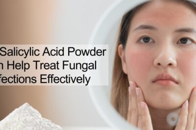 How Salicylic Acid Powder Can Help Treat Fungal Infections Effectively