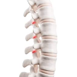 How Does Posture Affect Back Pain and What Can You Do About It?