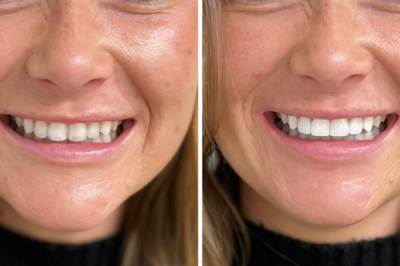 How Can Our Dental Experts Help You Maintain Healthy Teeth? How Can Our Dental Experts Help You Maintain Healthy Teeth?