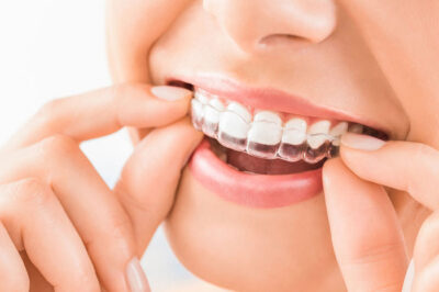 How Do Reviews Help in Finding the Best Dentist?