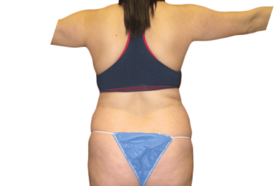 How Often Should You Visit a Dermatologist?