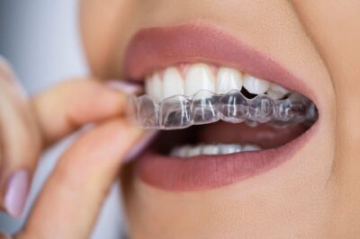 Dental Implants Europe: A Permanent Solution for Tooth Loss in the United Kingdom