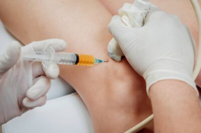 What Are the Most Common Knee Injuries Treated by Specialists?