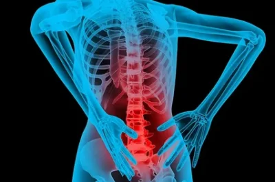 Understanding Spine Surgery An Essential Guide for Patients